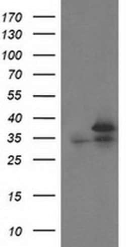 CDK2 Monoclonal Antibody (OTI1A8), TrueMAB , OriGene 30 &mu;L; Unconjugated:Antibodies,