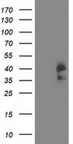 CDK2 Monoclonal Antibody (OTI5A10), TrueMAB , OriGene 30 &mu;L; Unconjugated:Antibodies,