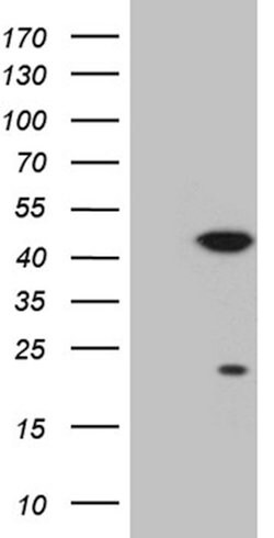 CDK20 Mouse anti-Human, Clone: OTI1B3, lyophilized, TrueMAB 100 &mu;g;