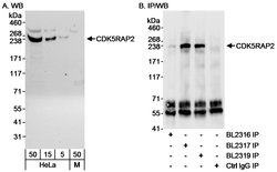 CDK5RAP2 Rabbit anti-Human, Polyclonal, Bethyl Laboratories 100 &mu;L;