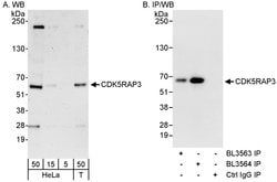 CDK5RAP3 Rabbit anti-Human, Polyclonal, Bethyl Laboratories 100 &mu;L;