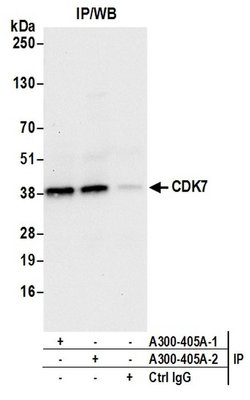 CDK7 Rabbit anti-Human, Mouse, Rat, Polyclonal, Bethyl Laboratories 100