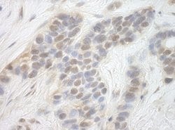 CDK8 Polyclonal Antibody, Bethyl Laboratories:Antibodies:Primary Antibodies