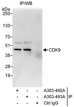 CDK9 Rabbit anti-Human, Polyclonal, Bethyl Laboratories 100 &mu;l; Unlabeled:Antibodies,