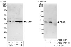 CDK9 Rabbit anti-Human, Mouse, Polyclonal, Bethyl Laboratories 100 &mu;L;