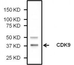 Invitrogen CDK9 Monoclonal Antibody (K.513.1) 100 &mu;L; Unconjugated:Antibodies,