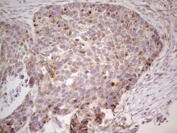 CDKL1 Monoclonal Antibody (OTI7F10), TrueMAB , OriGene 100 &mu;L; Unconjugated:Antibodies,