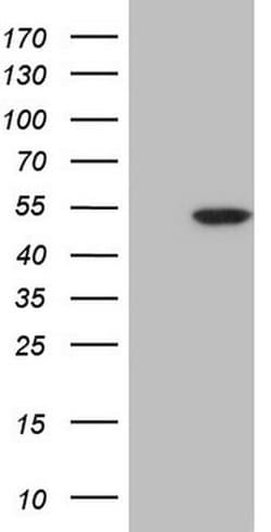 CDKL1 Monoclonal Antibody (OTI3E8), TrueMAB , OriGene:Antibodies:Primary