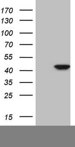 CDKL1 Monoclonal Antibody (OTI7B7), TrueMAB , OriGene 100 &mu;L; Unconjugated:Antibodies,