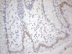CDKN1A Monoclonal Antibody (OTI7C8), TrueMAB , OriGene 100 &mu;L; Unconjugated:Antibodies,