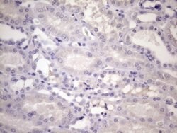 CDKN1A Monoclonal Antibody (OTI4B11), TrueMAB , OriGene 100 &mu;L; Unconjugated:Antibodies,