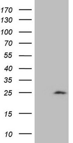 CDKN1A Mouse anti-Human, Clone: OTI6G2, lyophilized, TrueMAB 100 &mu;g;