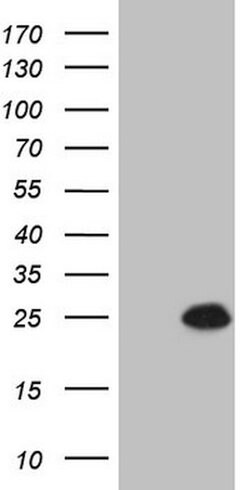 CDKN1A Mouse anti-Human, Clone: OTI2D3, lyophilized, TrueMAB 100 &mu;g;