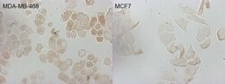 CDKN2A Mouse anti-Human, Clone: OTI1D3, lyophilized, TrueMAB 100 &mu;g;