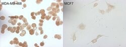 CDKN2A Mouse anti-Human, Clone: OTI2H7, lyophilized, TrueMAB 100 &mu;g;