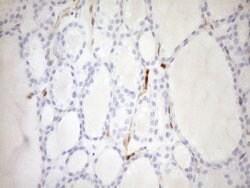 CDKN2A Monoclonal Antibody (OTI1H3), TrueMAB , OriGene 100 &mu;L; Unconjugated:Antibodies,