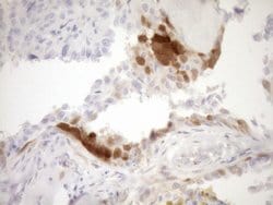 CDKN2A Monoclonal Antibody (OTI1H3), TrueMAB , OriGene 100 &mu;L; Unconjugated:Antibodies,