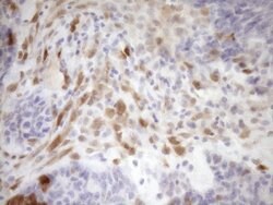 CDKN2A Monoclonal Antibody (OTI1H3), TrueMAB , OriGene 100 &mu;L; Unconjugated:Antibodies,