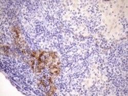 CDKN2A Monoclonal Antibody (OTI1H3), TrueMAB , OriGene 100 &mu;L; Unconjugated:Antibodies,