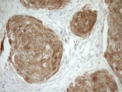 CDKN2A Monoclonal Antibody (OTI1H3), TrueMAB , OriGene 100 &mu;L; Unconjugated:Antibodies,
