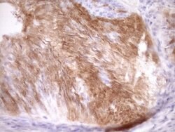 CDKN2A Monoclonal Antibody (OTI1H3), TrueMAB , OriGene 100 &mu;L; Unconjugated:Antibodies,