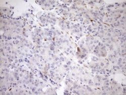 CDKN2A Monoclonal Antibody (OTI1H3), TrueMAB , OriGene 100 &mu;L; Unconjugated:Antibodies,
