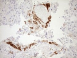 CDKN2A Monoclonal Antibody (OTI3G3), TrueMAB , OriGene 100 &mu;L; Unconjugated:Antibodies,