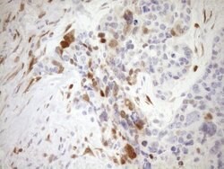 CDKN2A Monoclonal Antibody (OTI3G3), TrueMAB , OriGene 100 &mu;L; Unconjugated:Antibodies,