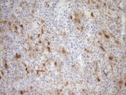 CDKN2A Monoclonal Antibody (OTI3G3), TrueMAB , OriGene 100 &mu;L; Unconjugated:Antibodies,