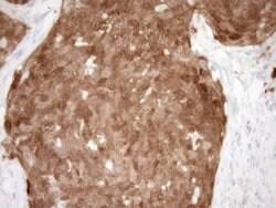 CDKN2A Monoclonal Antibody (OTI3G3), TrueMAB , OriGene 100 &mu;L; Unconjugated:Antibodies,