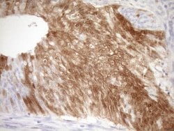 CDKN2A Monoclonal Antibody (OTI3G3), TrueMAB , OriGene 100 &mu;L; Unconjugated:Antibodies,