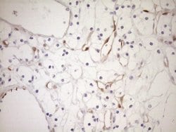 CDKN2A Monoclonal Antibody (OTI3G3), TrueMAB , OriGene 100 &mu;L; Unconjugated:Antibodies,