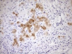 CDKN2A Monoclonal Antibody (OTI3G3), TrueMAB , OriGene 100 &mu;L; Unconjugated:Antibodies,