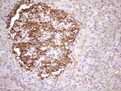 CDKN2A Monoclonal Antibody (OTI2G1), TrueMAB , OriGene 100 &mu;L; Unconjugated:Antibodies,