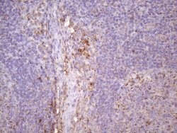 CDKN2A Monoclonal Antibody (OTI2G1), TrueMAB , OriGene 100 &mu;L; Unconjugated:Antibodies,