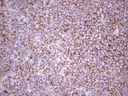 CDKN2A Monoclonal Antibody (OTI2G1), TrueMAB , OriGene 100 &mu;L; Unconjugated:Antibodies,