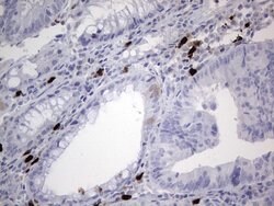 CDKN2A Mouse anti-Human, Clone: OTI5H5, lyophilized, TrueMAB 100 &mu;g;