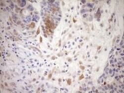 CDKN2A Monoclonal Antibody (OTI7A6), TrueMAB , OriGene 100 &mu;L; Unconjugated:Anticuerpos