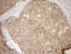 CDKN2A Monoclonal Antibody (OTI7A6), TrueMAB , OriGene 100 &mu;L; Unconjugated:Anticuerpos