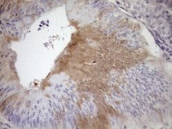 CDKN2A Monoclonal Antibody (OTI7A6), TrueMAB , OriGene 100 &mu;L; Unconjugated:Anticuerpos