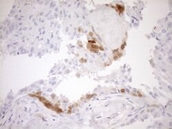 CDKN2A Monoclonal Antibody (OTI5G9), TrueMAB , OriGene 100 &mu;L; Unconjugated:Antibodies,