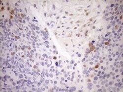 CDKN2A Monoclonal Antibody (OTI7B10), TrueMAB , OriGene 100 &mu;L; Unconjugated:Antibodies,