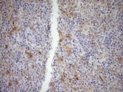 CDKN2A Monoclonal Antibody (OTI7B10), TrueMAB , OriGene 100 &mu;L; Unconjugated:Antibodies,