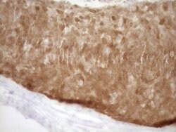 CDKN2A Monoclonal Antibody (OTI7B10), TrueMAB , OriGene 100 &mu;L; Unconjugated:Antibodies,