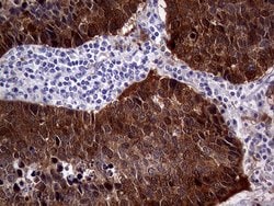 CDKN2A Monoclonal Antibody (OTI4H4), TrueMAB , OriGene 100 &mu;L; Unconjugated:Antibodies,