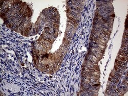 CDKN2A Monoclonal Antibody (OTI4H4), TrueMAB , OriGene 100 &mu;L; Unconjugated:Antibodies,