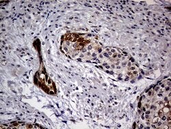 CDKN2A Monoclonal Antibody (OTI4H4), TrueMAB , OriGene 100 &mu;L; Unconjugated:Antibodies,