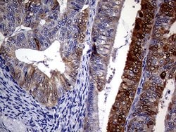 CDKN2A Monoclonal Antibody (OTI11D3), TrueMAB , OriGene 100 &mu;L; Unconjugated:Antibodies,