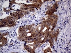 CDKN2A Monoclonal Antibody (OTI11D3), TrueMAB , OriGene 100 &mu;L; Unconjugated:Antibodies,