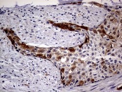 CDKN2A Monoclonal Antibody (OTI11D3), TrueMAB , OriGene:Antibodies:Primary